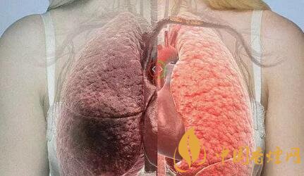 吸煙前后人體變化對比圖 有圖有真相